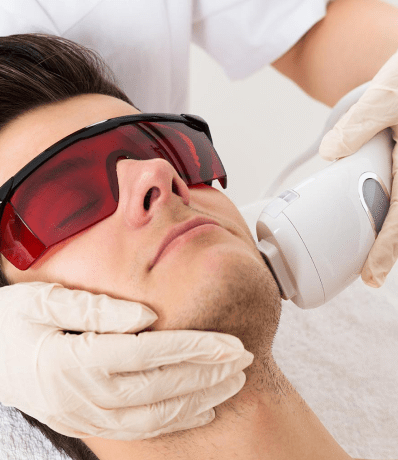 laser hair removal laser hair removal