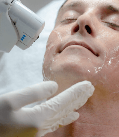 skin resurf skin resurf